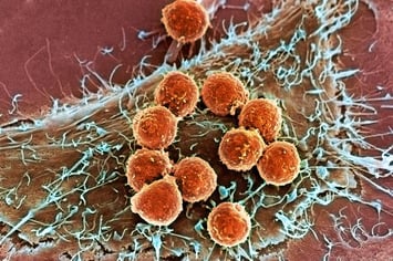 Cancer Cells Image